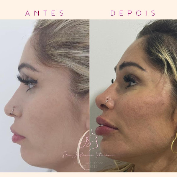Foto 3 de Clínica de Harmonização Facial e Odontologia Dra. Juliana Storino