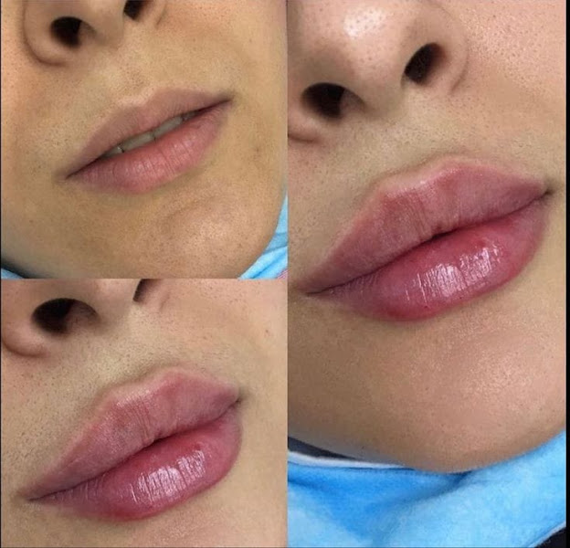Foto 2 de Clínica de Harmonização Orofacial - Dra. Ana Reis