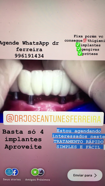 Foto 3 de Clínica de Implante Dentário I Cirurgião Dentista Dr José Antunes Ferreira I Clínica Odontológica em Balneário Camboriú