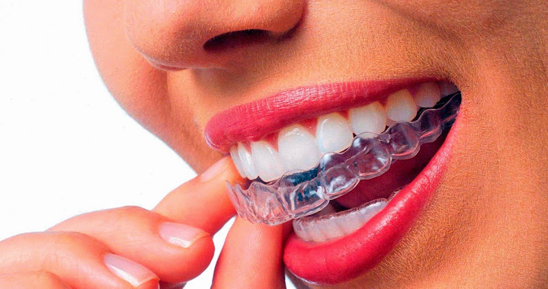 Foto 2 de Clínica de Odontologia Benedecti
