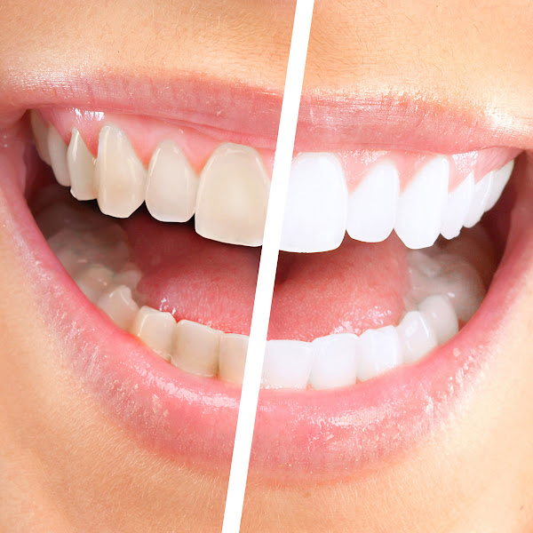 Foto 2 de Clínica de Odontologia Integrada Dr. Marco César Alvarenga