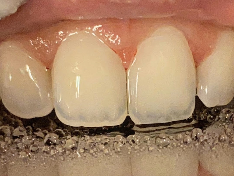 Foto 2 de Clínica de Odontologia UNIP Brasília