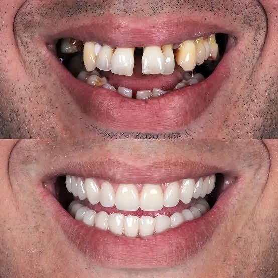 Foto 2 de Clínica de Ortodontia e implante dentário Dr. Marcelo Caetano