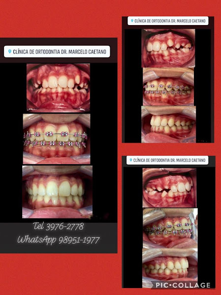 Foto 3 de Clínica de Ortodontia e implante dentário Dr. Marcelo Caetano