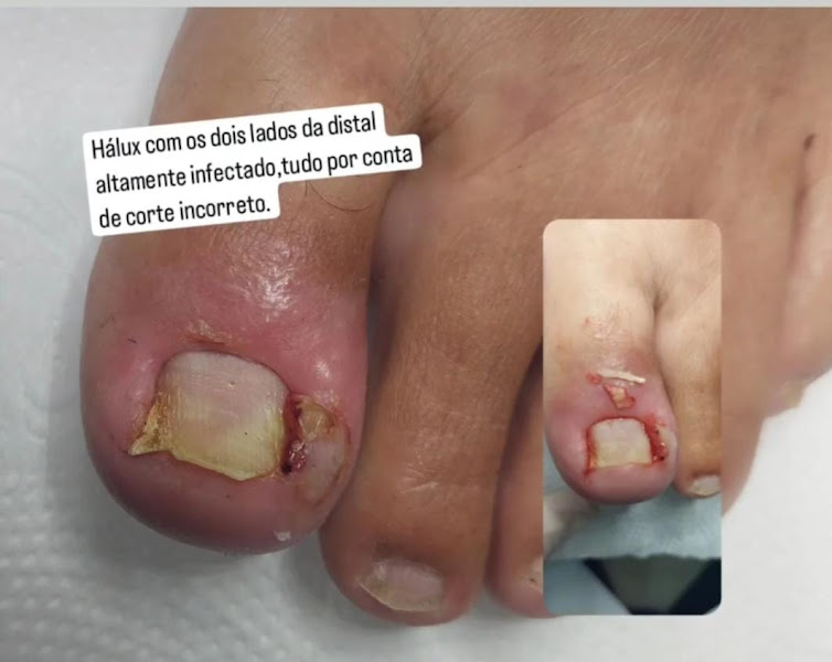 Foto 2 de Clínica de podologia