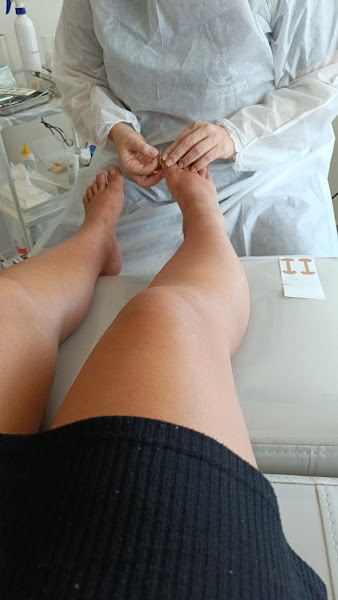 Foto 2 de Clínica de podologia / Ediane PODOLOGIA POPULAR | Podologia em Ananindeua | Podóloga em Ananindeua