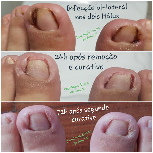 Foto 2 de Clínica de Podologia Eliana do Amaral