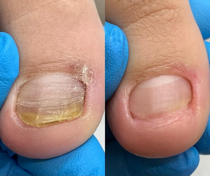 Foto 2 de Clinica de podologia Pirituba - Avenida Mutinga 2105 - Sp