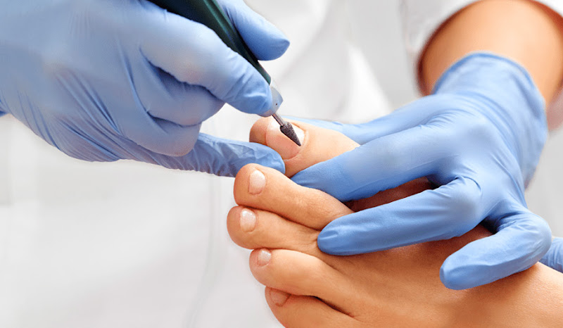 Foto 2 de Clínica de Podologia - Podóloga em Cruzeiro do Sul