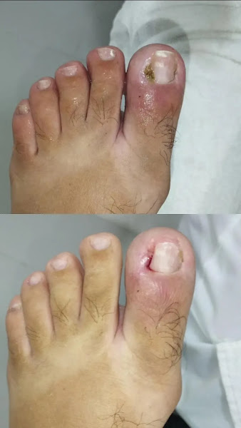 Foto 3 de Clinica de Podologia Saude dos Pés