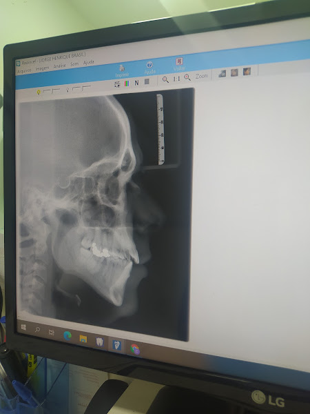 Foto 3 de Clínica de Radiologia Odontológica, Patos -PB