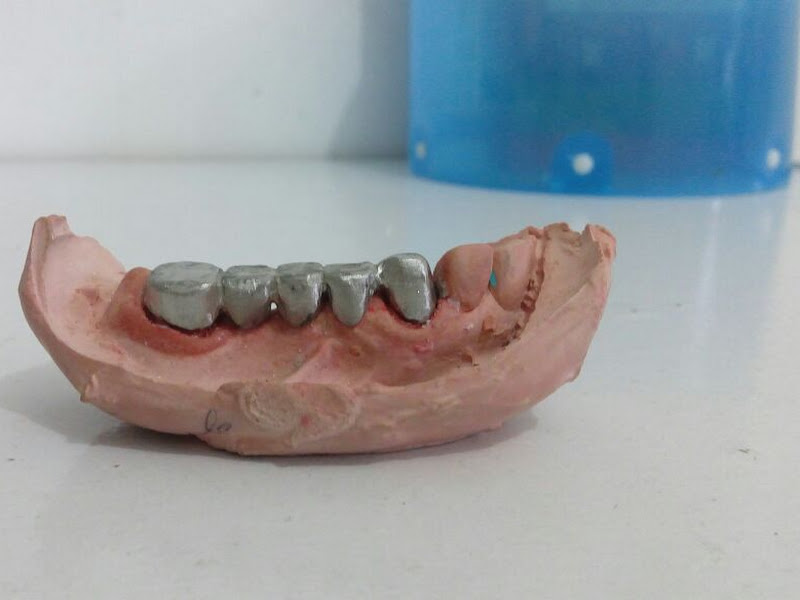 Foto 2 de Clínica de Reabilitação Oral de Itapoan