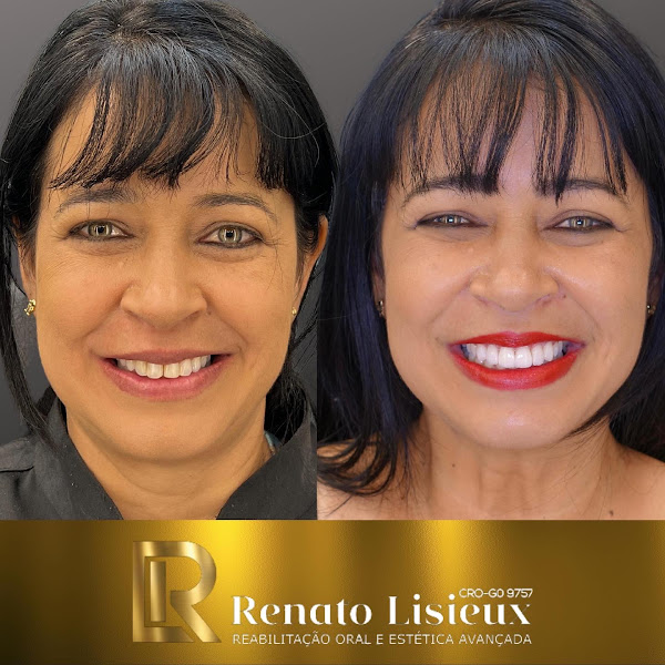 Foto 3 de Clínica de Reabilitação Oral e estética avançada Dr. Renato Lisieux