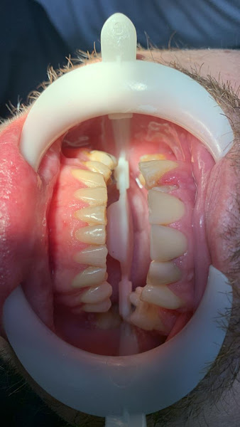 Foto 2 de Clinica Dental Plus | Odontologia e Estética