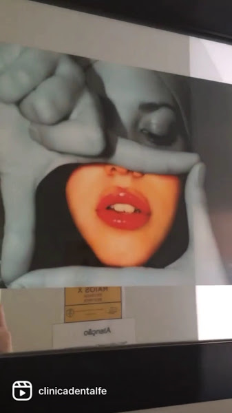 Foto 4 de Clínica DentalFe