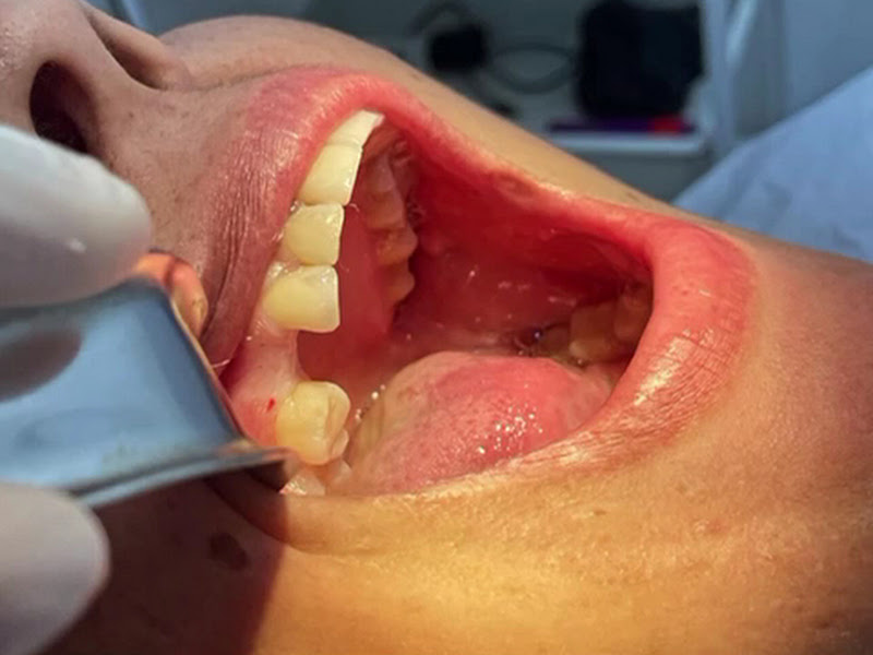 Foto 2 de Clínica dentária Maia Veneno