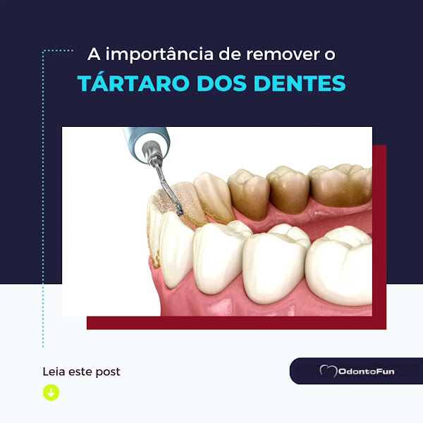Foto 3 de Clínica Dentária OdontoFun