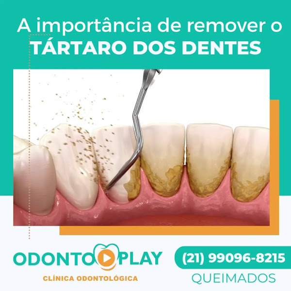 Foto 3 de CLÍNICA DENTÁRIA ODONTOPLAY