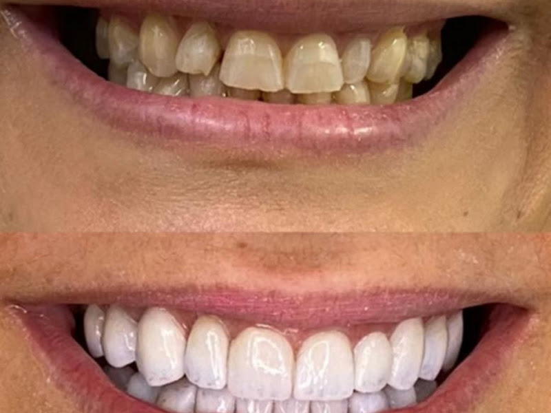 Foto 8 de Clínica Dentária Só Sorriso Betim