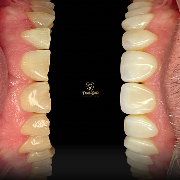 Foto 3 de Clinica DentBelle Odontologia