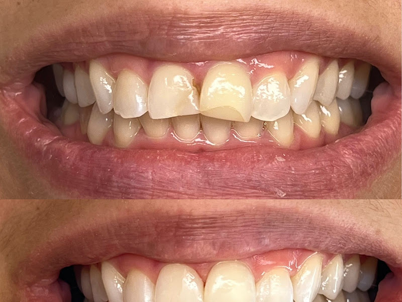 Foto 5 de Clinica Dentes - Dentistas Especializados em Feira de Santana