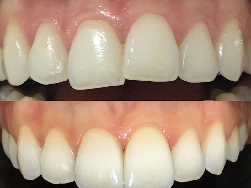 Foto 3 de Clínica Dentie