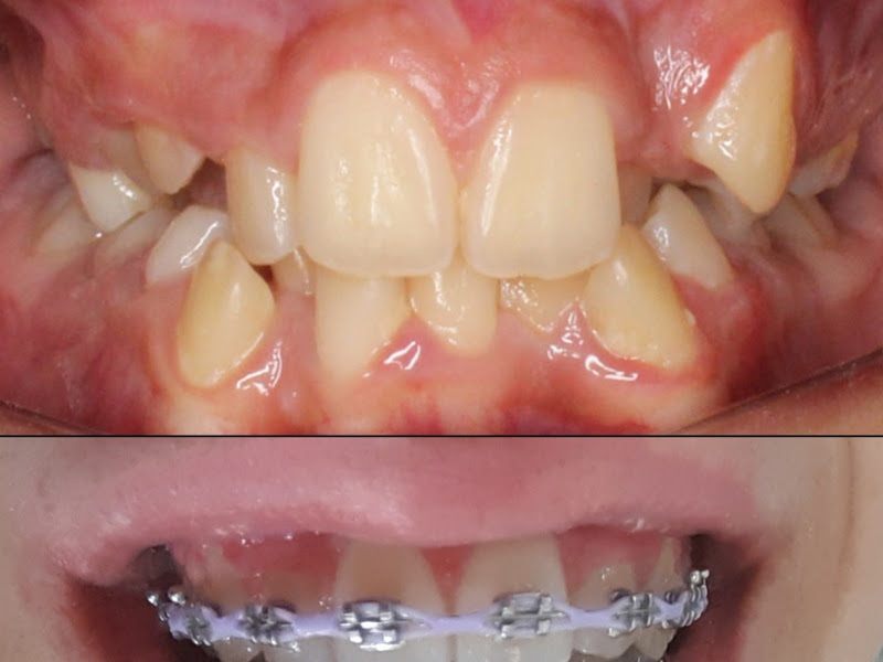 Foto 7 de Clínica Dentista do Povo