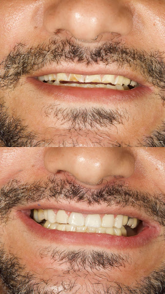 Foto 3 de Clínica Dentista do Povo - Uberlândia (Afonso Pena)