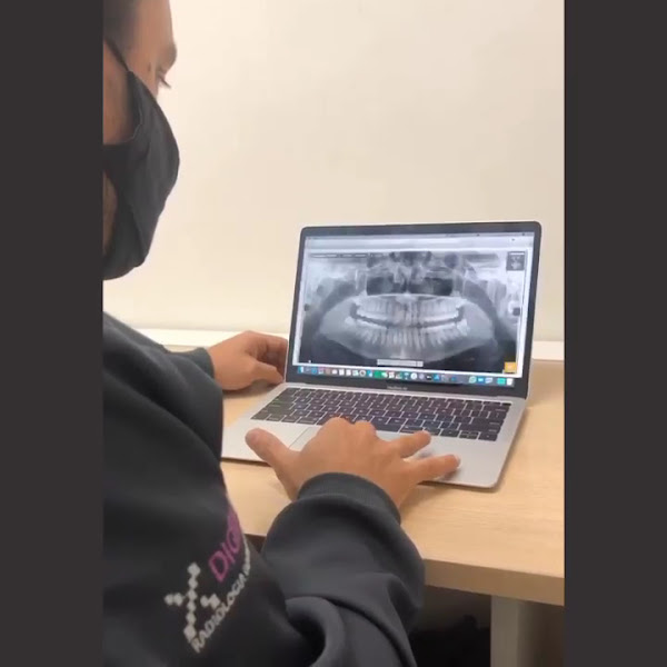 Foto 4 de Clínica Digital X - Radiologia Odontológica - Campos dos Goytacazes RJ