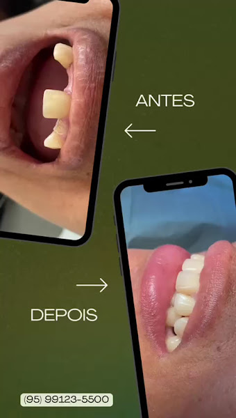 Foto 3 de Clínica do Dente