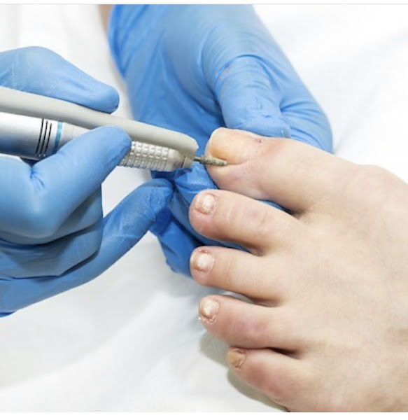 Foto 2 de Clinica dos Pés Itamar Pessoa