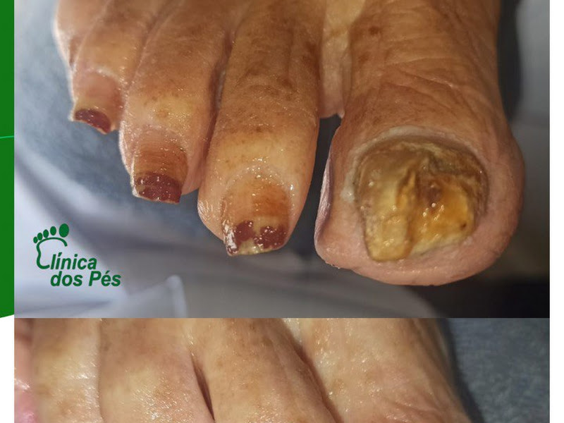 Foto de Clínica dos Pés - Planaltina - DF