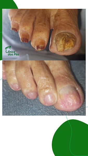 Foto 2 de Clínica dos Pés - Planaltina - DF