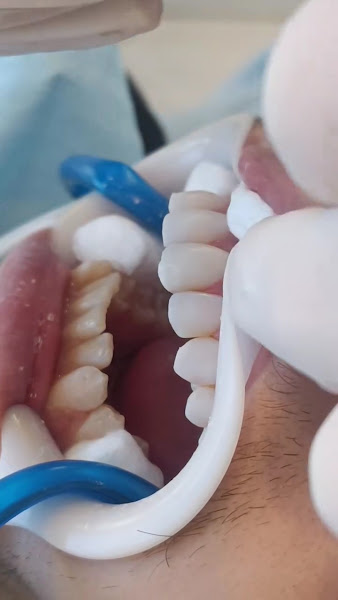 Foto 3 de Clínica Dossin Odontologia Especializada | Estética dental e facial | Implante dental