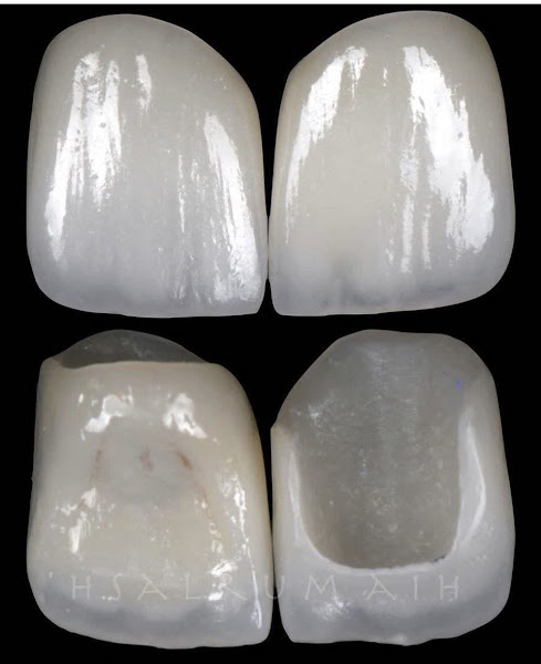 Foto 3 de CLINICA DR. ESCÓCIO ESTÉTICA & IMPLANTODONTIA