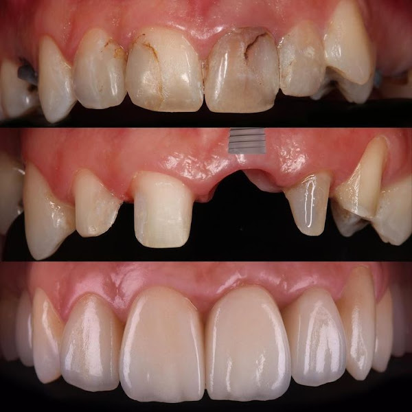 Foto 3 de CLINICA DR JOAQUIM NEVES-PRÓTESE & IMPLANTES