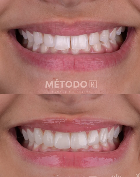 Foto 3 de Clínica Dr. Ricardo Gonçalves – Odontologia Estética