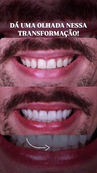 Foto 3 de Clínica Dr.Stenio Teixeira odontologia estética