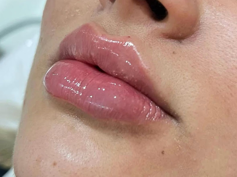 Foto 3 de Clínica Drª Taynara Xavier Harmonização Facial & Corporal