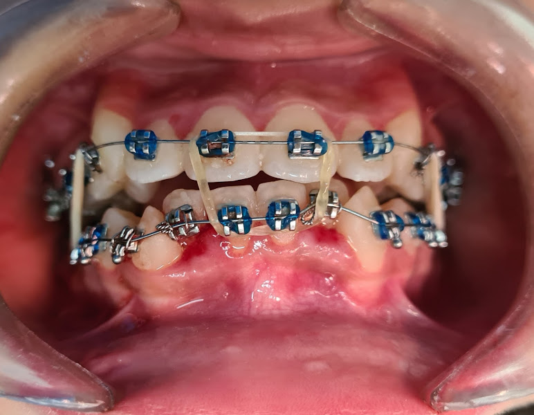 Foto 2 de Clínica Dr. Thiago Esmeraldo
