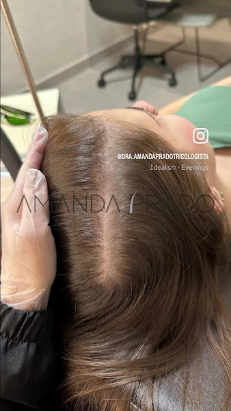 Foto 3 de Clínica Dra Amanda Prado - Tricologista