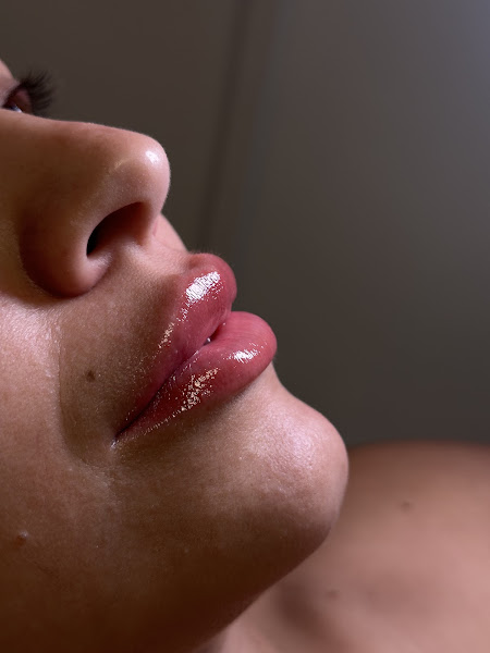 Foto 3 de Clínica Dra. Arliane Tássia