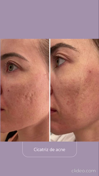 Foto 3 de Clínica Dra. Cristiane Oliveira em Jardim Guanabara | Limpeza Pele, Botox, Bioestimulador, Tratamento para Celulite, Estrias