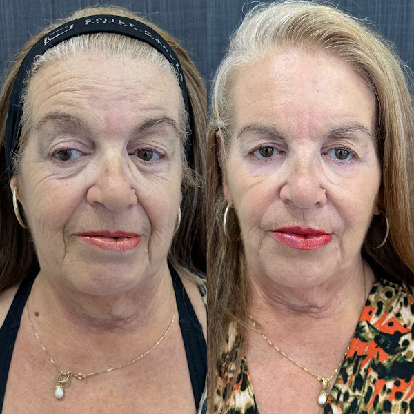 Foto 3 de Clínica Dra. Emily Galvão