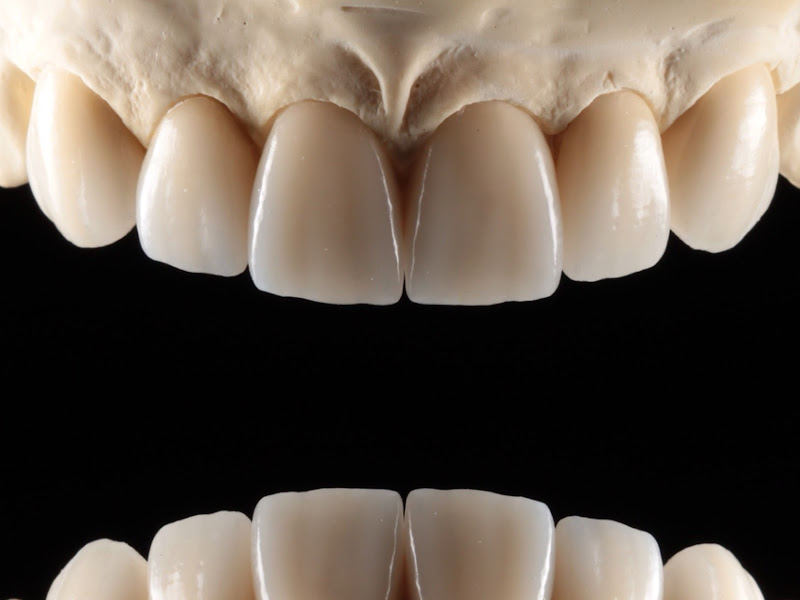 Foto 8 de Clínica Dra. Gabriela Dantas | Dentista Mossoró/RN