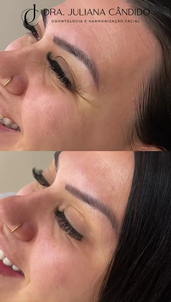 Foto 3 de Clínica Dra Juliana Cândido - Harmonização Facial e Odontologia