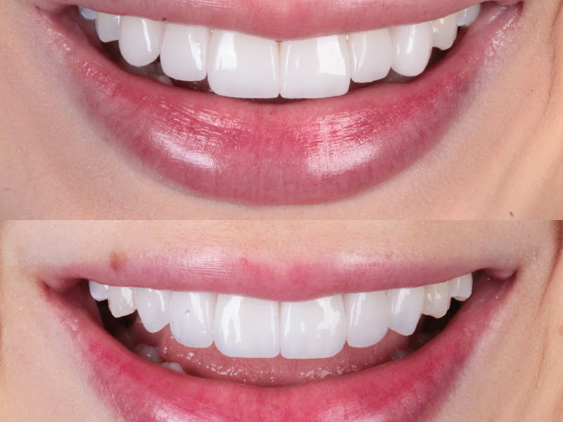 Foto 8 de Clínica Dra. Karine Peixotto | Implantes, Clareamento e Ortodontia