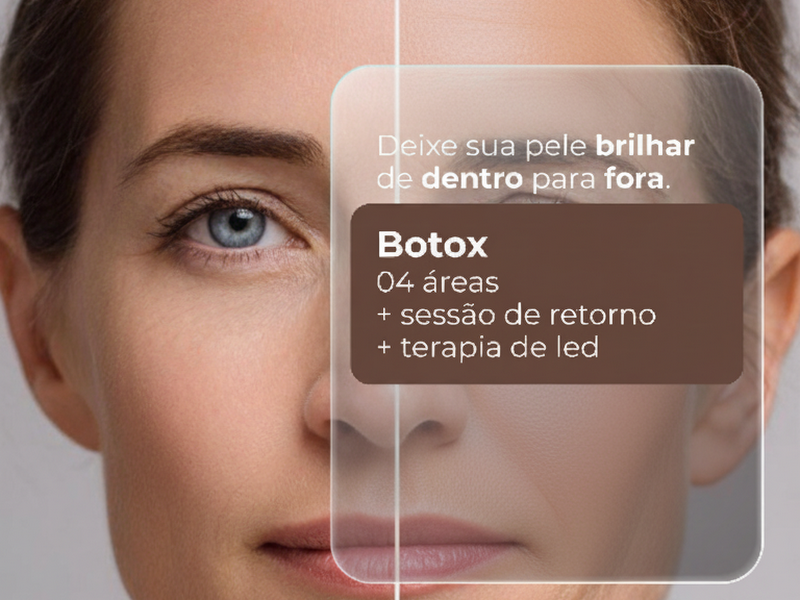 Foto 9 de Clínica Dra Mayara Bezerra Estética Avançada Em Caruaru | Toxina Botulínica (Botox) | Harmonização Facial Em Caruaru