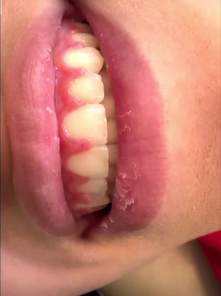 Foto 4 de Clínica Dra. Monnaliza Cabral