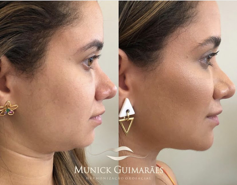 Foto 3 de Clínica Dra Munick Guimarães